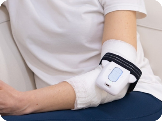 Braccio di una persona con bendaggio e una fascia di supporto, in uso il dispositivo medico Therapist impiantato sull'avambraccio.