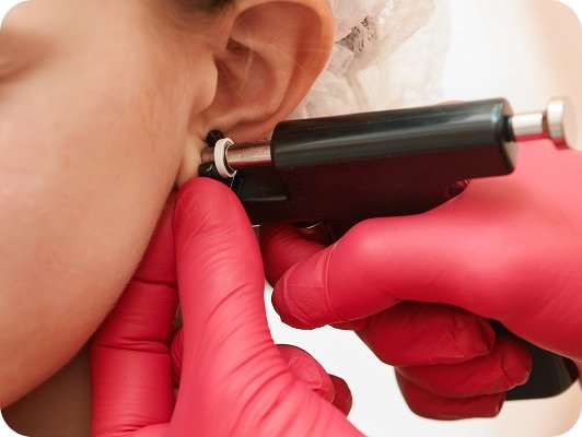 Intervento medico in orecchio con strumenti chirurgici: mani con guanti rosa tengono una pinza vicino al lobo.