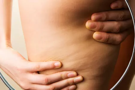 Analisi della pelle e cellulite