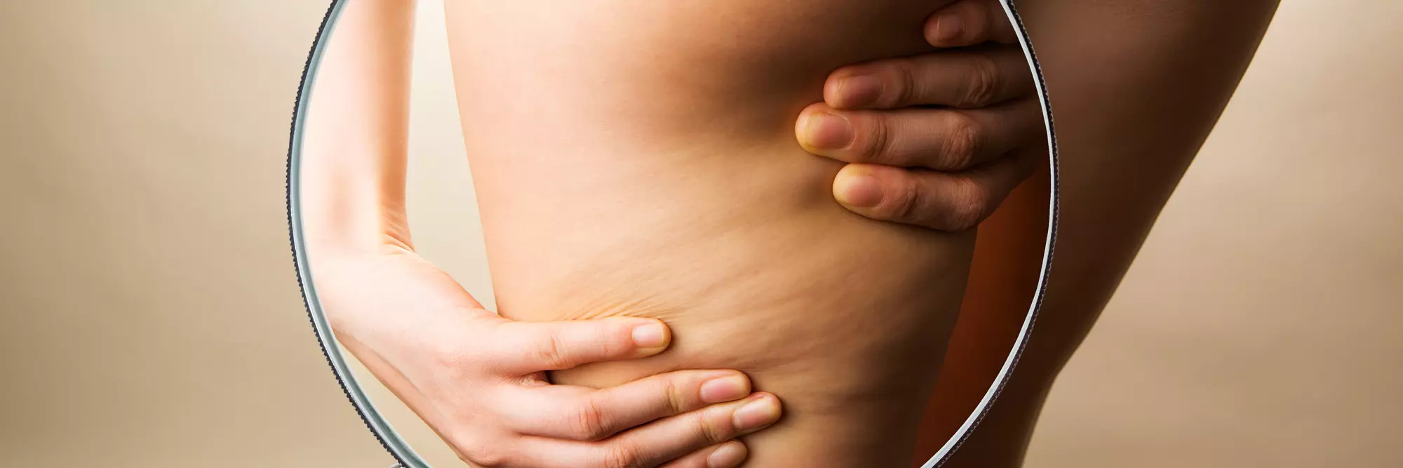 Primo piano addominale femminile con smagliature evidenti su lato sinistro, mani che toccano la pelle in controluce