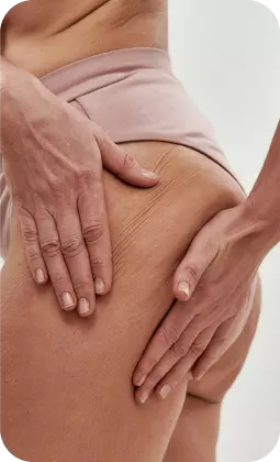 Mani che toccano una coscia con pelle leggermente rugosa e tono rosato