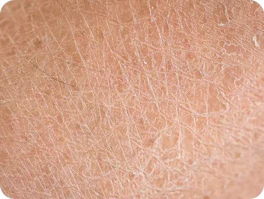 Primo piano pelle terrosa con linee sottili e texture croccante, evidenziando i pori e le piccole crepe sulla superficie.