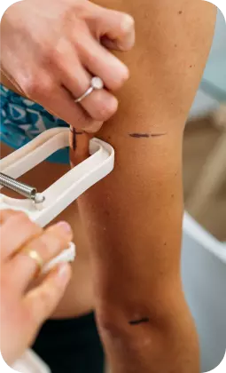 Misurazione della grandezza di un braccio con pinze mediche bianche