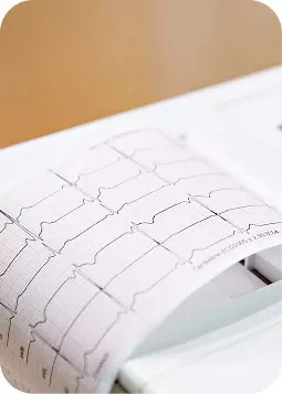 Elettrocardiogramma su carta da monitoraggio, con linee a onde sul tracciato, sfondo neutro, tono medico e tecnico.