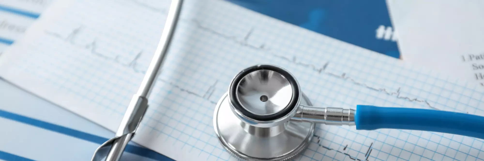 Stetoscopio posizionato su un grafico a griglia con linee orizzontali, simbolo di monitoraggio medico e diagnostica.