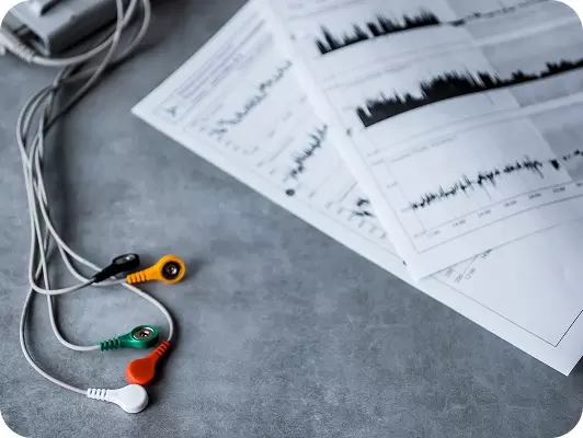 Primo piano su elettrodi e fogli che presentano i risultati dopo un elettrocardiogramma