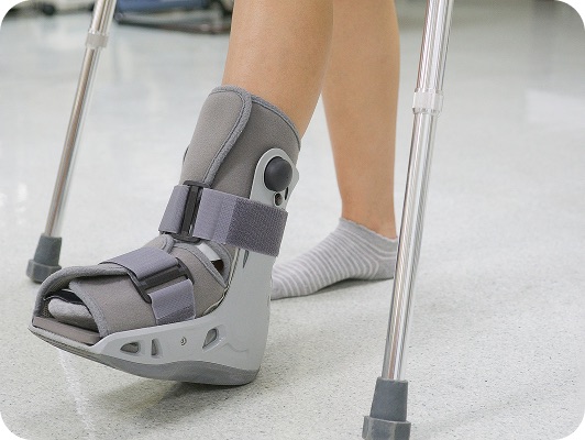 Gamba sinistra immobilizzata con tutore gessato e stampelle, ripresa in ambientazione clinica.